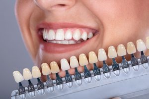 Estética Dental en Parla, Estética Dental en Seseña